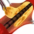 Was ist Cholesterin?