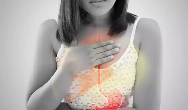 Reflux bei einer Gastritis